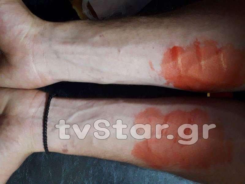 Σχολιασμός πάνω σε διαδικτυακά δημοσιεύματα που αναφέρονται σε επίθεση λύκου σε κτηνοτρόφο στη Στερεά Ελλάδα